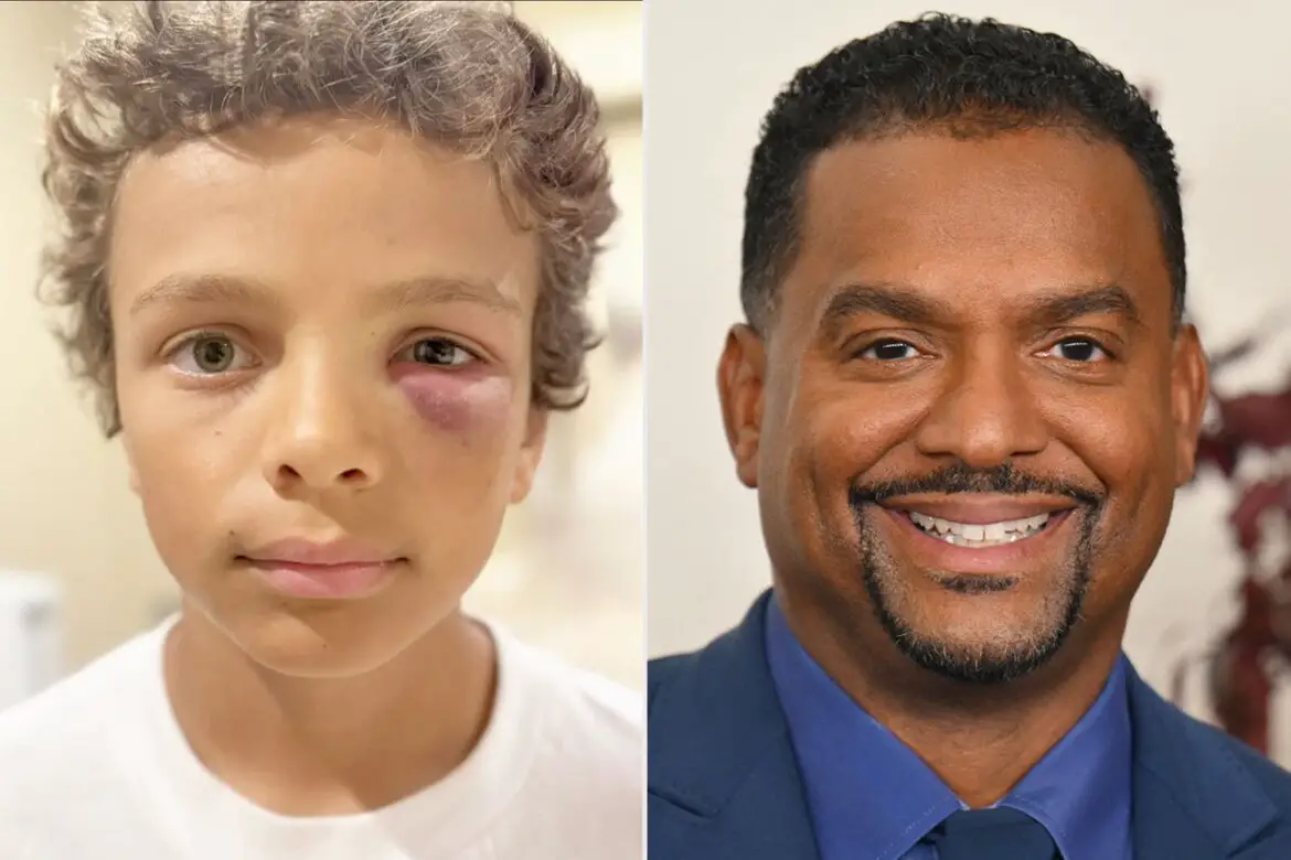 Alfonso Ribeiro’s Wife Reveals Son AJ, 10, Got Black Eye from Baseball ArticlePure